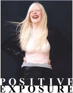 Rick Guidotti's POSITIVE EXPOSURE